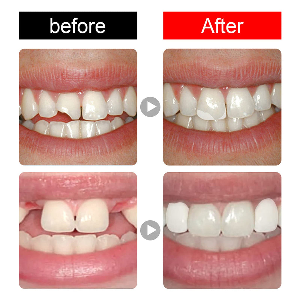 168 Pieces Acrylic Resin Denture Teeth 6 Sets 23 Shade A2 Upper + Lower V666