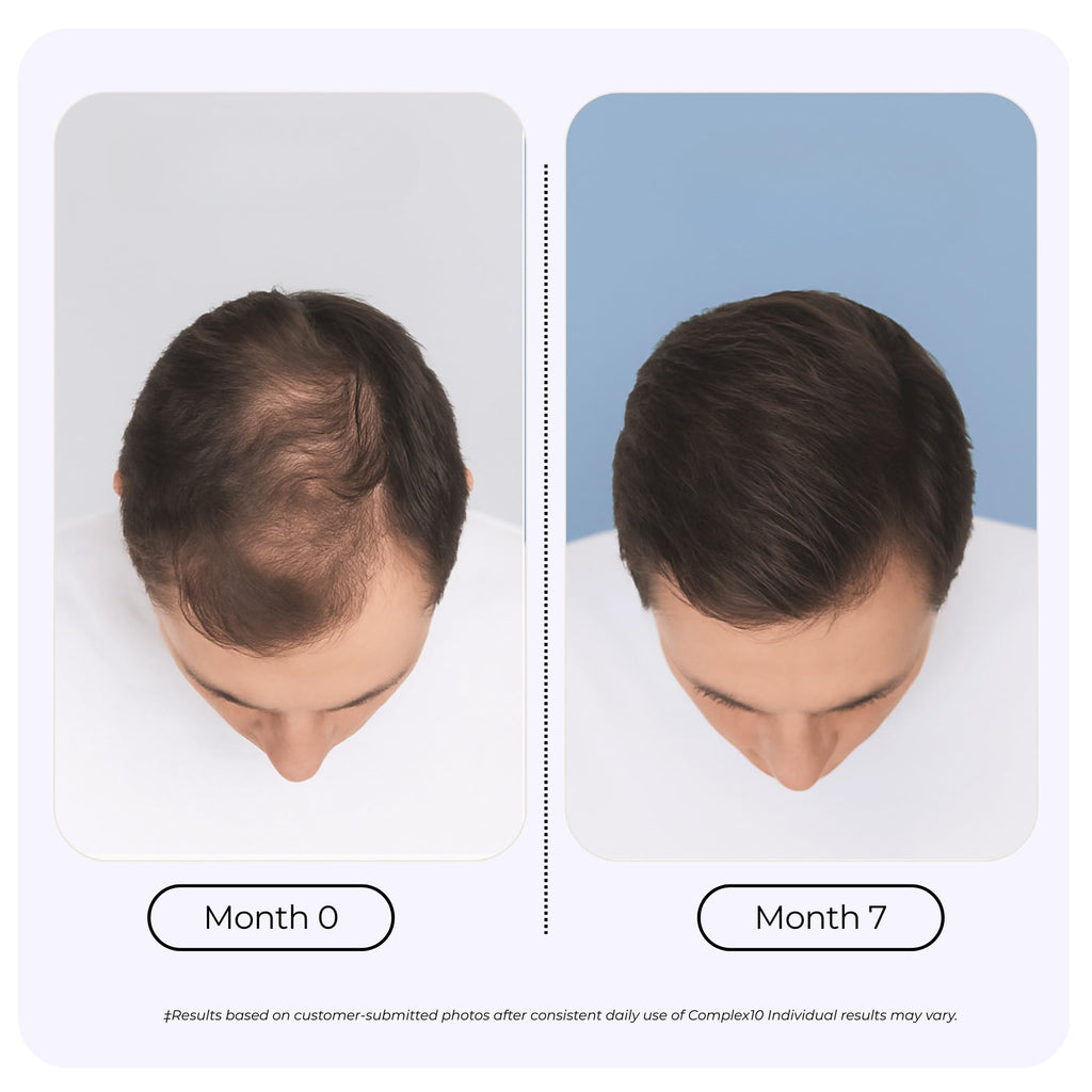 Biotin Collagen Hair Support Supplement 30 Capsules P856