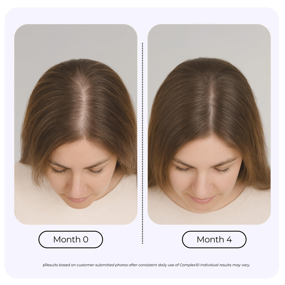 Biotin Collagen Hair Support Supplement 30 Capsules P856